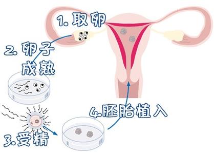 私人拉拉借卵代怀助孕咨询